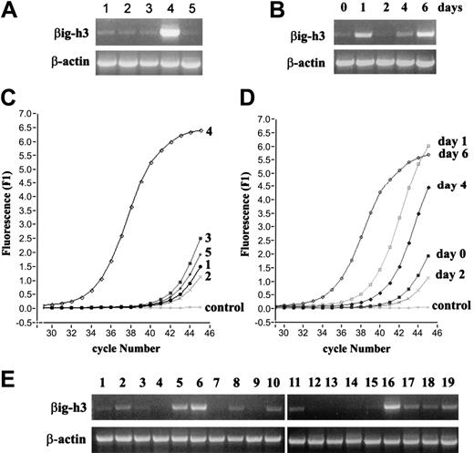 Figure 2. Examination of βig-h3 gene expression by RT-PCR. (A) Preferential βig-h3 gene expression in imDCs. RNA was isolated from: (1) monocytes, (2) macrophages, (3) LPS-activated macrophages, (4) imDCs, and (5) mDCs. RT-PCR was performed using βig-h3–specific and β-actin primers. (B) Monocytes were cultured in the presence of GM-CSF and IL-4 and harvested at the indicated time points up to 6 days. RNA was isolated from these cells and used in RT-PCR. (C) Real-time PCR for βig-h3 expression in the different cell types. RNA samples obtained as in panel A were subjected to 45 cycles of PCR using the Light Cycler and FastStart DNA Master SYBR Green I kit. “Control” indicates that cDNA template was omitted. β-Actin expression in the 5 RNA samples was similarly examined which gave Ct values of 36.48 to 37.15 showing little variation in cDNA inputs between different samples. (D) Real-time PCR analysis of βig-h3 expression during monocyte differentiation into imDCs. The RNA samples are as in panel B. The Ct values for β-actin are 31.92 (day 0), 31.47 (day 1), 32.52 (day 2), 32.03 (day 4), and 31.91 (day 6). These variations do not significantly affect the conclusion drawn based on the βig-h3 expression data. Melting curves for all reactions exhibited single specific PCR product (data not shown). (E) RT-PCR was performed with 19 human tissue RNA samples using βig-h3 primers. The RNA samples are: (1) adrenal gland, (2) bone marrow, (3) brain, (4) fetal brain, (5) colon, (6) small intestine, (7) kidney, (8) liver, (9) fetal liver, (10) lung, (11) placenta, (12) prostate, (13) salivary gland, (14) skeletal muscle, (15) spinal cord, (16) spleen, (17) testis, (18) trachea, and (19) uterus. PCR reactions in panels A-B and E were separated on 1% (wt/vol) agarose gels and visualized using ethidium bromide.