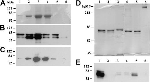 Figure 3. Purification of recombinant βig-h3 and identification of its secretion by imDCs. (A-C) Elution fractions of βig-h3 from the Ni-NTA-agarose column. 293T medium was mixed with Ni-NTA-agarose and bound βig-h3 was eluted using imidazole collecting 6 fractions (0.15 mL); 25 μL of each fraction was subjected to 10% SDS-PAGE under reducing conditions. The gels were either stained with Coomassie blue (A) or electroblotted. The blots were developed with either an anti–βig-h3 antibody (B) or an anti-myc antibody (C). (D) Purified βig-h3 and, as molecular weight standards, human IgM (Sigma-Aldrich) were subjected to 7.5% SDS-PAGE with (lanes 1-3) or without (lanes 4-6) 2-mercaptoethanol treatment. βIg-h3 was also purified in the presence (lanes 1 and 4) or absence (lanes 2 and 5) of iodoacetamide. As a control, purified human IgM was similarly analyzed (lanes 3 and 6). The gel was stained with Coomassie blue. (E) Media from 293T cells transfected with pβig-h3-MH (lane 1) or pcDNA3.1 (lane 2) or media from monocytes (lane 3), macrophages (lane 4), imDCs (lane 5), and mDCs (lane 6) were subjected to 10% SDS-PAGE, under reducing conditions, followed by Western blotting with a mouse anti–human βig-h3 antiserum. All molecular weight standards are in kilodaltons.