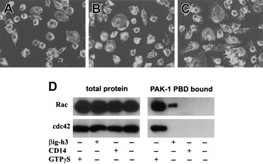 Figure 6. Membrane ruffling and Rac activation in βig-h3–stimulated macrophages. Macrophages cultured on glass coverslips were either untreated (A) or stimulated with purified CD14 (B) or βig-h3 (C). The cells were fixed in formaldehyde and examined using a LSM510 laser-scanning microscope and Zeiss LSM Image Browser software. (D) Rac and cdc42 activation in βig-h3–stimulated macrophages. Macrophages were stimulated with βig-h3 or CD14 for 30 minutes or unstimulated before lysis. The cleared cell lysates were incubated with PAK-1 PBD-agarose. As a positive control, the unstimulated cell lysate was incubated with GTPγS before incubation with PAK-1 PBD-agarose. The bound proteins were subjected to Western blotting using anti-Rac and anti-cdc42 antibodies as indicated. As controls, an equal volume of total macrophage lysate for each treatment was also similarly analyzed. The blots were developed using alkaline phosphatase–conjugated goat anti–mouse IgG.