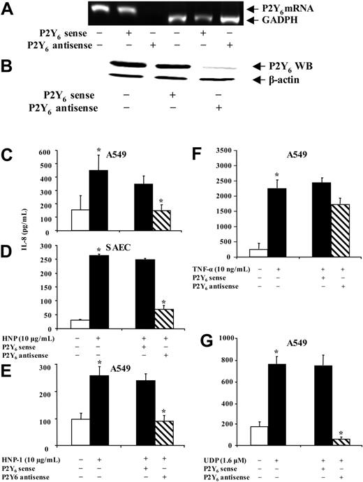 Figure 6. P2Y6 mediates HNP-induced IL-8 production in human lung epithelial cells. A549 cells grown in complete DMEM were transfected with 2.5 μM P2Y6 sense or antisense oligonucleotides for 4 hours. After washing, cells were incubated in complete medium overnight. (A) Total RNA was extracted, and RT-PCR of P2Y6 mRNA was performed. (B) Total P2Y6 protein level was determined from cell lysates by Western blotting (WB). After transfection with the oligonucleotides overnight, A549 cells (C) or SAEC cells (D) were incubated in serum-free DMEM containing the purified HNP for 8 hours. Three control groups were included to test the specificity of the antisense oligonucleotides on IL-8 release after stimulation with commercial synthetic HNP-1 (E), TNF-α (F), or UDP (G) in A549 cells. IL-8 levels in cell-culture supernatants were measured (n = 3). *P < .05; sense compared with antisense.
