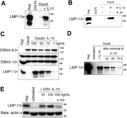 Figure 2. Induction of LMP-1 by IL-10 in Daudi cells. (A) Immunoblot analysis of LMP-1 expression of Daudi cells 48 hours after incubation with 100 ng/mL hIL-10. Total cell extracts of Raji and DG75 cells were used as positive and negative controls, respectively. The numbers on the right side denote the molecular weight in kDa. (B) Immunoblot analysis of LMP-1 expression of hL-10-treated (100 ng/mL) Daudi cells in the presence or absence of IL-10 receptor-blocking antibody (2 μg/mL). (C) EBNA-6, EBNA-1, and LMP-1 immunoblot of Daudi cells treated with 100, 50, 10, or 1 ng/mL hIL-10 for 48 hours. (D) LMP-1 immunoblot of IL-10-treated Daudi cells after the removal of the cytokine. Forty-eight hours after of incubation with 100 ng/mL hIL-10 the cells were washed and replated in the absence of IL-10. Total protein extracts were prepared 24, 48, and 72 hours after the removal of hIL-10 and expression of LMP-1 was monitored by immunoblotting. (E) Total cell extracts of Daudi cells incubated with 10 or 100 ng/mL EBV IL-10 for 48 hours were analyzed for LMP-1 and β-actin expression by SDS-PAGE and immunoblotting. In parallel cultures, Daudi cells were preincubated with 2 μg/mL anti-IL-10R-blocking antibody before the addition of 100 ng/mL cytokine. Of note: because of the low expression of LMP-1, the loading of the cell extracts and the exposure time were optimized, and therefore the immunoblot is not comparable with the other LMP-1 immunoblots.