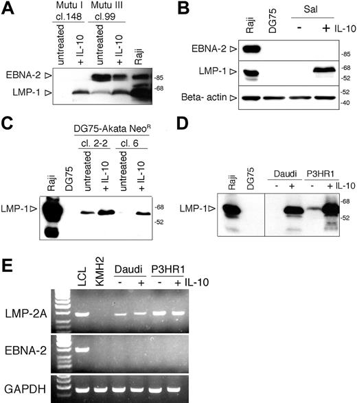 Figure 4. Induction of LMP-1 by IL-10 in other BL lines. (A) Total cell extracts of hIL-10-treated (50 ng/mL, 48 hours) Mutu I cl.148 and Mutu III cl.99 were analyzed for EBNA-2 and LMP-1 expression by SDS-PAGE and immunoblotting, developed on the same membrane. (B) Immunoblot analysis of LMP-1, EBNA-2, and β-actin expression in total cell extracts of IL-10-treated Sal BL cells (50 ng/mL, 48 hours). (C) Total cell extracts of hIL-10-treated (50 ng/mL, 48 hours) DG75-Akata NeoR clones 2-2 and 6 were analyzed for EBNA-2 and LMP-1 expression by SDS-PAGE and immunoblotting. (D) Immunoblot analysis of LMP-1 expression in total cell lysates of IL-10-treated Daudi and P3HR1 cells (50 ng/mL, 6 hours). (E) RT-PCR results of LMP-2A, EBNA-2, and GAPDH expression of untreated and IL-10-treated (50 ng/mL, 24 hours) Daudi and P3HR1 cells. cDNAs prepared from the LCL B95-8 and the EBV-negative Hodgkin lymphoma cell line KMH2 were used as positive and negative controls, respectively. The PCR products were visualized in ethidiumbromide-stained agarose gels. The first lane contains 3 μL of GeneRuler 50-bp DNA ladder (MBI, Fermentas, Vilnius, Lithuania).