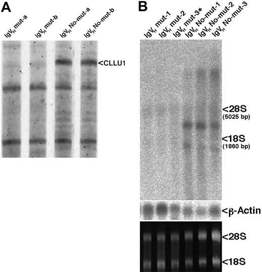 Figure 1. Identification and expression of CLLU1. (A) Autoradiogram of differential display screening gel. The 4 patient samples were only used for the screening. (B) Northern blot analysis of CLLU1 expression, using the differential display fragment as probe. The same blot was subsequently probed with a probe specific for β-actin. An ethidium bromide stain of the gel before transfer to the nylon filter is shown at the bottom. The weak bands across the gel at the positions where 28S and 18S rRNAs are located were probably derived from nonspecific hybridization to the rRNAs.