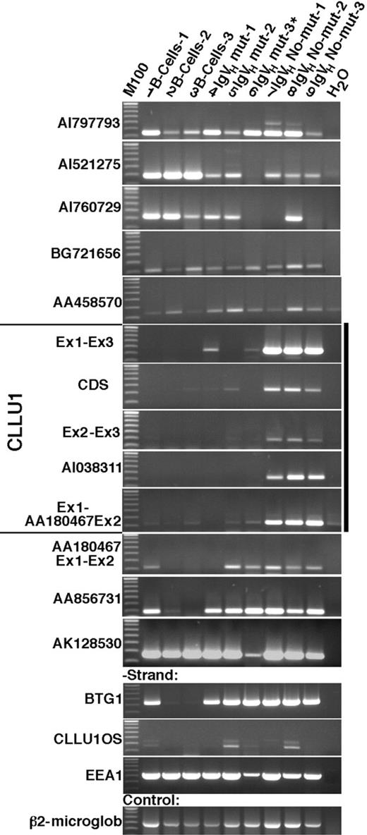 Figure 3. RT-PCR analysis of expression of transcripts in the 12q21.33-12q22 region. Three B-cell preparations from healthy donors and the patient samples previously analyzed by Northern blotting were analyzed by RT-PCR using primers specific for the genes, ESTs, and CLLU1 transcripts shown in Figure 2 (for a list of primers and analyzed transcripts, see Table S1). The size marker is a 100-bp ladder, and the top band in all images corresponds to 800 bp.