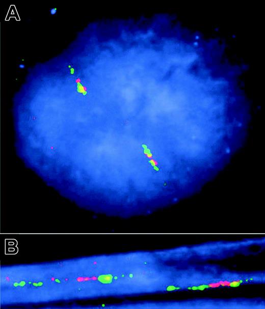 Figure 5. Two-color FISH analysis of gene copy number on interphase nuclei and DNA fibers in a patient without IgVH mutations. (A) FISH to interphase nuclei with slightly extended DNA fibers. (B) FISH to highly extended DNA fibers. Three BAC clones (Figure 2) were visualized either by FITC (green) (AC026113 and AC012083) or by TexasRed (red) (AC063949). Because of the order and differential overlap of the 3 BAC clones, the expected order of the coloring is green-red-yellow-green. Inspection of a high number of nuclei and extended DNA fibers failed to reveal any additional gene copies, and the order of the BAC clones along the chromosomes, when possible to analyze, was as expected.