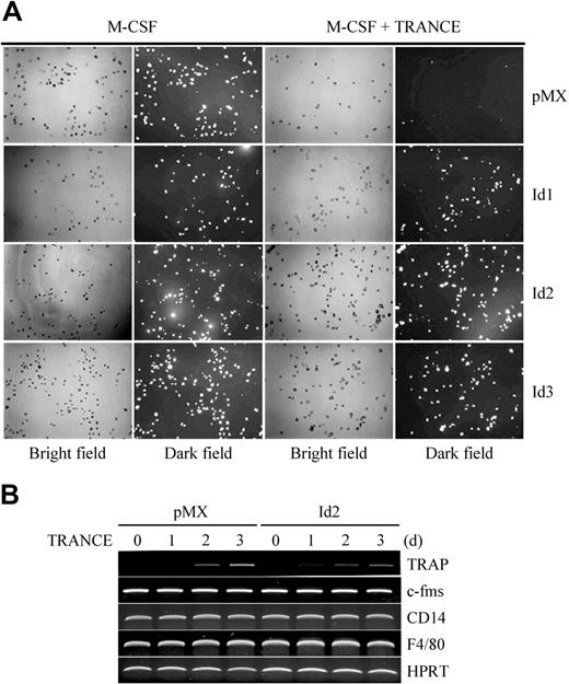Figure 3. Overexpression of Id genes in BMMs does not affect phagocytosis. (A) BMMs were transduced with pMX-IRES-EGFP (control), Id1, Id2, or Id3 retrovirus and cultured for 2 days with M-CSF alone or M-CSF and TRANCE. Cultured cells were incubated with fluorescein-conjugated zymosan particles for 1 hour and washed with PBS. Cells were fixed and observed with UV illumination under a microscope. Fluorescein-conjugated zymosan particles incorporated by the cells appear as bright dots in the dark field (original magnification, ×100). (B) BMMs were transduced with control (pMX-IRES-EGFP) or Id2 retrovirus and cultured for the indicated days with M-CSF and TRANCE. RT-PCR was performed for the expression of TRAP, c-fms, CD14, F4/80, and HPRT. Images were acquired as described for Figure 2.