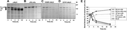 Figure 1. Pro-αIIb containing either of 2 Glanzmann thrombasthenia mutations is degraded at the same rate as normal pro-αIIb. Cells were transiently transfected with cDNA constructs expressing both normal αIIb and β3 (Nl) (A), αIIb alone (B), or the αIIb mutants V298F (VF; C) or I374T (IT; D) in combination with β3. At 36 hours, cells were metabolically labeled with 35S-methionine/cysteine and then harvested at the indicated time points. Radiolabeled protein was immunoprecipitated using a combination of the αIIb-specific mAbs, B1B5 and M-148; the samples were then subjected to SDS-PAGE under reducing conditions, and dried gels were exposed to film. Arrowheads indicate bands representing pro-αIIb, mature αIIb, and β3; the migration of molecular weight standards is shown on the right. (E) Band intensities representing each subunit were measured by densitometry and plotted as a percentage of maximum band density of pro-αIIb (at 2 hours for Nl and at 0 hours for VF and IT). The times to half-maximum appearance of mature αIIb and β3 were both 2 plus or minus 1 hours (n = 5).