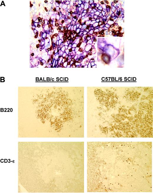 Figure 5. Tumor infiltration with T cells in the absence of tolerogenic APCs. (A) C57BL/6 SCID mice were adoptively transferred intravenously with 1 × 106 naive anti-HA CD4+ T cells. One day later, they were challenged with 1 × 106 A20HA given intravenously. Twenty-one days after tumor challenge, mice were humanely killed, and histologic sections of their spleens were stained with anti-B220 antibody (violet) to identify tumor cells and with anti-CD3-ϵ (brown) to identify T cells by immunohistochemistry. Slides were then counterstained with hematoxylin (blue). Close contact between tumor cells and T cells is revealed (inset). (B) BALB/c SCID (left) or C57BL/6 SCID (right) mice were challenged with 1 × 106 A20HA intravenously on day 0. Fourteen days later, tumor-bearing mice were adoptively transferred with 1 × 106 anti-HA-specific CD4+ T cells. One week later, mice were humanely killed, and their livers were removed. Serial histologic sections were performed and stained as detailed.