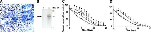 Figure 1. Detection of Eap in wounds and effect of Eap on wound healing. (A) Eap detection in S aureus–infected wounds. (B) Eap was detected by Western blot analysis in extracts of noninfected (lane 1) or S aureus–infected (lane 2) wounds. Molecular mass markers are indicated along the right margin. (C) The course of wound closure is shown in the absence (buffer; •), or in the presence of wild-type S aureus (▪) or the Eap-deficient strain (□). *P < .05 compared with buffer-treated wounds; #P < .05 compared with wounds that received the Eap-deficient strain; **P < .05 compared with buffer-treated wounds. (D) The course of wound closure is shown in the absence (•) or presence of 20 μg Eap (▪) or protein A (▵). *P < .05 compared with buffer-treated wounds. Wound closure is expressed relative to the wound size of each wound at day 0 that represents 100%. Data are expressed as mean ± SD (n = 8).