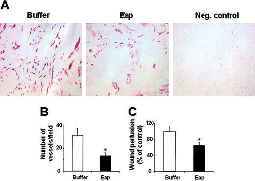 Figure 4. Eap inhibits neovascularization in wound healing. (A) Typical photomicrographs (× 100 magnification) of immunohistochemical staining for the detection of PECAM-1 (CD31) in association with blood vessels at day 5 following wound generation in the absence (buffer) or presence of 20 μg Eap is shown. Negative control (first antibody omitted) is also shown. (B) Statistical evaluation of the density of CD31-positive blood vessels (expressed as number of vessels/field) in wound sections at day 5 following wound generation in the absence (buffer) or presence of 20 μg Eap is shown. Evaluation of 7 fields per wound from 8 wounds per treatment group is shown. (C) Mice were anesthetized and fluorescent microbeads were injected. The recovered fluorescence per weight of wound tissue is shown, and data expressed relative to control (buffer-treated wounds) are means ± SD of 10 wounds. *P < .01 compared with control.