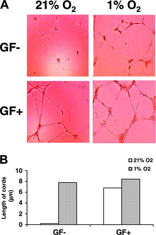 Figure 1. Hypoxia induces cord formation in HUVECs. (A) HUVECs were seeded on growth factor–reduced Matrigel in GF+ or in GF– medium. Cells were then cultured under 21% O2 (normoxia) or 1% O2 (hypoxia) for 16 hours. Cord formation was examined by phase-contrast microscopy at × 10 magnification. Results are representative of 3 independent experiments. (B) HUVECs were cultured as described in panel A. Every well was divided in 3 different parts, and the length of cords was counted in each part using the Bioquant Image Analysis System.