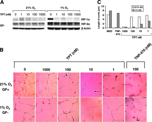 Figure 3. Topotecan inhibits HIF-1α but not HIF-2α in endothelial cells. (A) HUVECs cultured in GF– medium were incubated under normoxic or hypoxic conditions in the presence or absence of topotecan at the indicated concentrations for 16 hours. HIF-1α and HIF-2α protein accumulation was performed by immunoblotting; β-actin is shown as loading control. (B) HUVECs were seeded on Matrigel in GF+ medium under normoxic condition or in GF– medium under hypoxic conditions for 16 hours in the absence or presence of topotecan (1000 nM to 1 nM) or TNP-470 (100 nM), and cord formation was examined. Results are representative of 3 independent experiments.(C) Length of cords from the experiment shown in panel B was quantified using the Bioquant Image Analysis System.