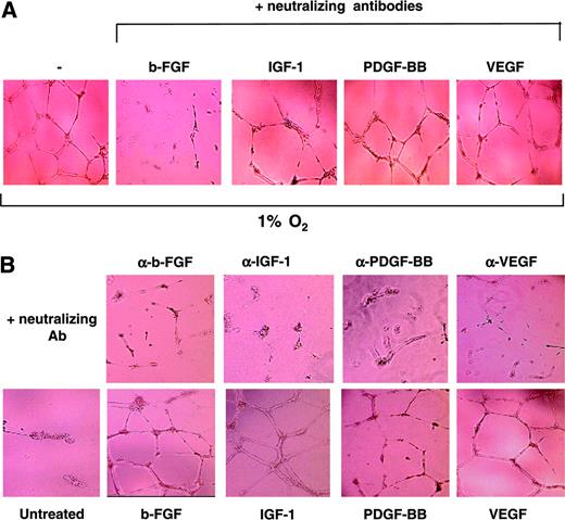 Figure 4. bFGF is involved in hypoxic induction of cords in HUVECs. (A) HUVECs seeded on Matrigel in GF– medium were incubated under hypoxic conditions for 16 hours in the presence or absence of specific neutralizing antibodies for IGF-1, VEGF, bFGF, and PDGF-BB (100 ng/mL). (B) HUVECs were treated with 20 ng/mL IGF-1, VEGF, bFGF, or PDGF-BB, in the presence or absence of the specific neutralizing antibodies (100 ng/mL) for 16 hours, and cord formation was examined. Results are representative of 4 independent experiments.