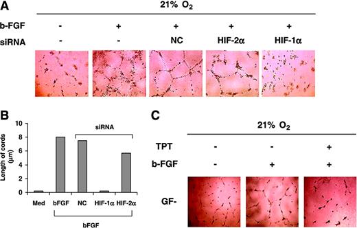 Figure 6. HIF-1α siRNA and TPT inhibit cord formation induced by bFGF. (A) HUVECs transfected with the indicated siRNA were seeded on Matrigel in GF– medium and treated in the presence or absence of bFGF (20 ng/mL) under normoxic conditions for 16 hours, and cord formation was examined. (B) Length of cords from the experiment shown in panel A was quantified using the Bioquant Image Analysis System as described above. (C) HUVECs were cultured as indicated in panel A under normoxic conditions for 16 hours in the presence or absence of bFGF (20 ng/mL) or TPT (0.1 μM), and cord formation was examined. Results are representative of 4 independent experiments.
