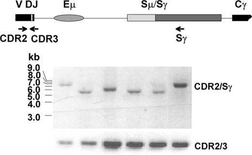 Figure 6. Several independent recombinations took place in clonal class switching of WM. Subclones of CDR2/Sγ fragments amplified from CD40L/IL-4 activated B cells of WM1-17 (Figure 5D) were shown to have variable size. Each one was confirmed clonotypic by CDR2/CDR3 analysis and direct sequencing.