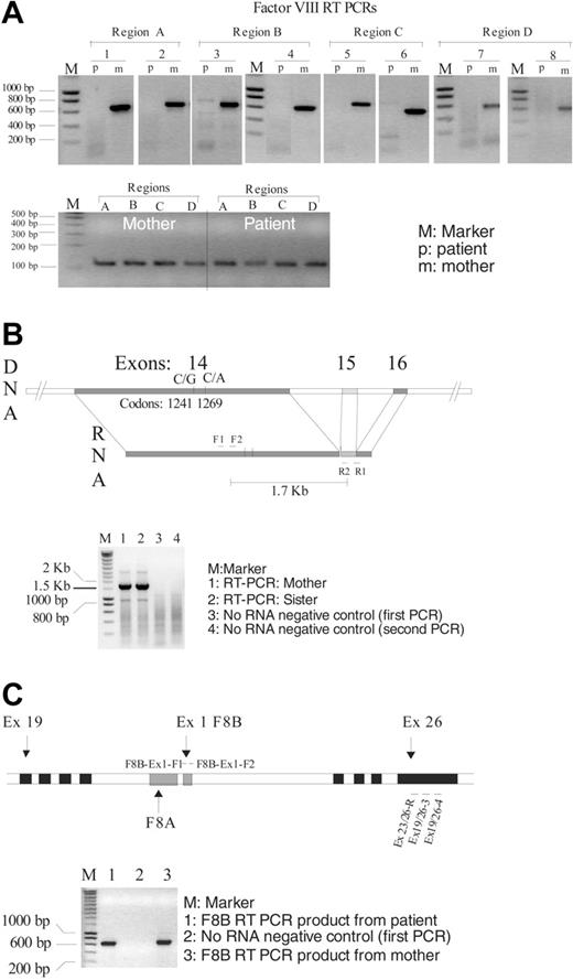 Figure 1. RT-PCR analysis in F8. (A) RT-PCR picture in F8 from both the patient (p; showing no product) and his mother (m; with positive product). Different RT-PCR regions of the F8 are indicated by Reg A (exons 1-8), B (exons 8-14), C (exons 14-19), and D (exons 19-26), whereas the nested PCRs are labeled 1 to 8. An internal control for the success of the reverse transcription, in the PBGD gene, is also shown (A, bottom panel). The PBGD control primer used for the RT was included in each of the RT reactions of the F8 gene. The PCRs from the control PBGD gene and the F8 gene were done separately (regions A, B, C, and D correspond to the same regions in the top part of the figure). (B) A schematic diagram showing the relative positions of the informative markers in F8 exon 14, a picture of the 1.7 kb (kilobase) RNA-specific RT-PCR product that covers exon 15 and the polymorphic markers in exon 14 is also shown. (C) Schematic diagram of the intron 22 region showing the 2 nested genes F8A and F8B. The position of the primers used for the reverse transcription (Ex 19/26-4) and the 2 subsequent PCRs are also shown (first PCR, F8B-Ex1-F1/Ex 19/26-3; second PCR, F8B-Ex1-F2/Ex 23/26-R). A representative picture of the RT-PCR product of the F8B is also shown. Primers are listed in Table 1.