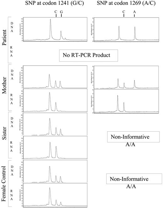 Figure 2. HPLC chromatograms of the single nucleotide primer extension product to distinguish the 2 alleles in exon 14 to 15 RT-PCRs. The presence of 2 peaks in the DNA-PCR (C and G at codon 1241 and C and A at codon 1269, respectively) indicate that this is an informative marker in females. The analysis of the DNA-PCR product that showed 2 alleles (2 peaks) and the RT-PCR product that showed the presence of only 1 allele (1 peak) indicate a monoallelic expression.