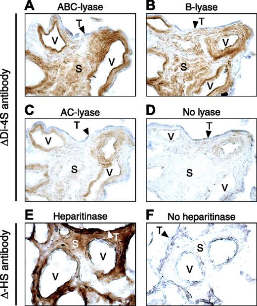 Figure 4. Immunohistochemical localization of placental GAGs. Frozen sections were incubated with chondroitin ABC–lyase (A), B-lyase (B), AC II–lyase (C), heparitinase (E), or buffer alone (D,F) and then stained with ΔDi-4S antibody (A-D) or Δ-HS antibody (E,F). V indicates vessel; S, stroma; and T (arrowheads), syncytiotrophoblast layer. Original magnification, 400 ×.