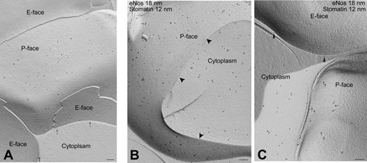 Figure 2. Subcellular localization of NOS protein in RBCs. (A) Stomatin label is found exclusively on the P-face of the plasma membrane. No label is seen on the E-face or the cytoplasm. The arrows indicate stomatin label over cross-fractured P-face. (B) Fracture of a single RBC permits simultaneous viewing of portions of the plasma membrane (P-face) and the cytoplasm. Gold markers of distinct sizes were used to identify eNOS (18-nm gold) and stomatin (12-nm gold). Both are present on the P-face of the plasma membrane, whereas merely eNOS is found in the cytoplasm. Arrowheads indicate the line of fracture plane between the plasma membrane and the cytoplasm. (C) In contrast to the positive staining in the cytoplasm and the P-face of the RBC membrane, neither eNOS label nor stomatin label is found on the E-face of the plasma membrane. Bars, 0.2 μm.