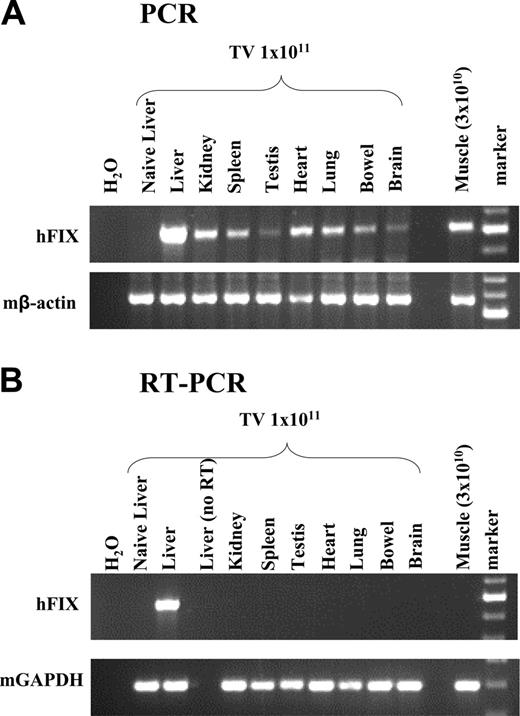 Figure 5. Biodistribution of scAAV2/8-LP1-hFIXco following tail-vein administration of vector. (A) PCR analysis of 1 μg genomic DNA, isolated from the indicated organs 6 weeks after tail-vein (TV) administration of 1 × 1011 particles using primers unique to hFIXco designed to amplify a 617-bp product. Control consists of genomic DNA extracted from the liver of an untransduced animal. scAAV2/8-LP1-hFIXco vector particles (3 × 1010) were also administered directly into the quadriceps muscle for comparison. Genomic DNA (1 μg) extracted from the muscle tissue was subjected to PCR using identical conditions. Integrity of DNA was determined by amplifying a 604-bp region of the murine β-actin gene and is shown at the bottom panel. (B) RT-PCR analysis. Expression analysis of hFIXco mRNA by RT-PCR following tail-vein injection of 1 × 1011 or intramuscular administration of 3 × 1010 scAAV-LP1-hFIXco particles or mock-transduced mice (Naive liver). RNA samples were amplified with and without RT to exclude genomic DNA amplification. Integrity of the RNA was determined by amplifying a 295-bp region of the murine GAPDH gene and is shown at the bottom panel.