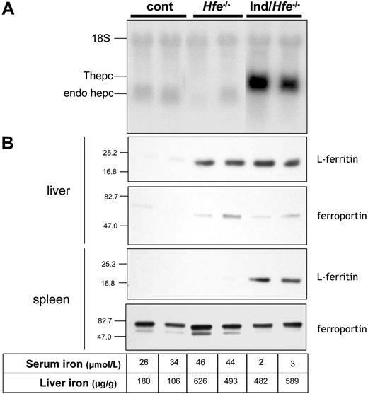 Figure 3. Characterization of mice carrying the inducible hepcidin transgenes crossed with Hfe-/- mice after treatment for 3 weeks with doxycycline. In this figure, each column represents the same animal. (A) Hepcidin mRNA levels in the livers of control (cont), Hfe-/- and inducible/Hfe-/- mice (ind/Hfe-/, ie, mice harboring both tetO-Hepc1 and rTALAP-1 transgenes and with Hfe-/- genotype) treated for 3 weeks with doxycycline. Total liver RNA (20 μg) was fractionated by electrophoresis, blotted, and hybridized with hepcidin and 18S-labeled probes. (B) Ferritin and ferroportin levels as assessed by immunoblot analysis of livers and spleens of control, Hfe-/- and ind/Hfe-/- mice treated for 3 weeks with doxycycline. Anti-mouse L-ferritin antibody was used to probe 20 μg hepatic (top panel) or splenic (bottom panel) cytosolic extract. Anti-mouse ferroportin antibody was used to probe 50 μg hepatic (top panel) or 20 μg splenic (bottom panel) microsomal extract. Molecular weight markers (kDa) are indicated on the left. The levels of serum iron and liver iron are shown for each animal.