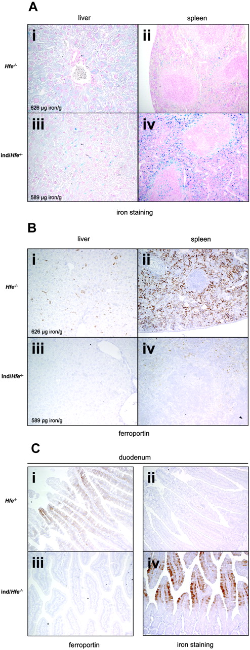 Figure 4. Perls staining and tissue ferroportin protein levels of liver, spleen, and duodenum sections from mice carrying the inducible hepcidin transgenes crossed with Hfe knockout (Hfe-/-) mice and treated for 3 weeks with doxycycline. (A-B) Typical Perls staining (A) and ferroportin immunodetection (B) using anti-mouse ferroportin antibody of liver (i,iii; original magnification × 40 in panel A and × 20 in panel B) and spleen (ii,iv; original magnification × 10) sections from Hfe-/- (i-ii) and ind/Hfe-/- mice (ie, mice harboring both tetO-Hepc1 and rTALAP-1 transgenes and with Hfe-/- genotype; iii-iv). Nonheme iron stains blue. The liver iron content for each animal is shown. (C) Duodenum (original magnification × 20) was stained for iron (ii,iv, Perls DAB staining, nonheme iron stains brown) and ferroportin (i,iii) immunodetection in Hfe-/- (i-ii) and in ind/Hfe-/- mice (ie, mice harboring both tetO-Hepc1 and rTALAP-1 transgenes and with Hfe-/genotype; iii,iv). All microscopy was performed using a Nikon Eclipse E800 microscope equipped with 10 ×/0.45, 20 ×/0.75, and 40 ×/0.95 oil-immersion objective lenses. Digital images were captured with a Nikon DXM1200 camera, and were acquired and processed with Nikon AC7-1 2.63 software (all from Nikon France, Champigny-sur-Marne, France).