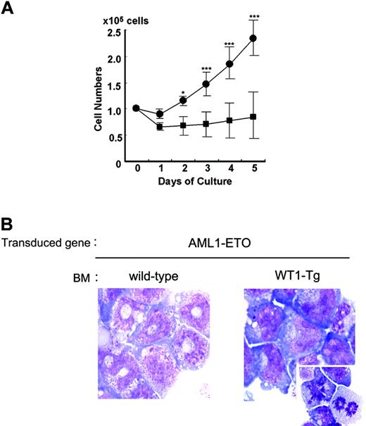 Figure 4. Coexpression of WT1 inhibits the AML1-ETO-expressing myeloid progenitors at more immature stages and lets them expand. One hundred thousand lineage-negative (Lin-) cells of the AML1-ETO-transduced wild-type BM cell-derived colonies and AML1-ETO-transduced WT1-Tg BM cell-derived colonies were cultured in medium containing IL-3 and G-CSF for 5 days. (A) Proliferation of these cells in response to G-CSF + IL-3. Lin- cells of the AML1-ETO-transduced wild-type BM cell-derived colonies (▪) and Lin- cells of the AML1-ETO-transduced WT1-Tg BM cell-derived colonies (•). Numbers of viable cells were counted by the trypan blue exclusion method. The mean values ± SD of 5 independent assays for each group are shown. *P < .01; ***P < .001. (B) May-Giemsa staining of these cells after culturing for 5 days (original magnification, × 1000). Stainings were analyzed using a Zeiss AxioSkop2 Plus microscope and a 100 ×/1.30 NA oil objective (both from Carl Zeiss, Oberkochen, Germany), and images were processed using AxioVision software version 3.0 (Carl Zeiss) and Adobe Photoshop CS. (Left) Lin- cells of the AML1-ETO-transduced wild-type BM cell-derived colonies. Myelocytes and metamyelocytes can be seen. (Right) Lin- cells of the AML1-ETO-transduced WT1-Tg BM cell-derived colonies. Myeloblasts with finely reticulated chromatin, 2 or more nucleoli, gray-blue cytoplasm, a few azurophilic cytoplasmic granules, and myeloblasts undergoing cell division can be seen.