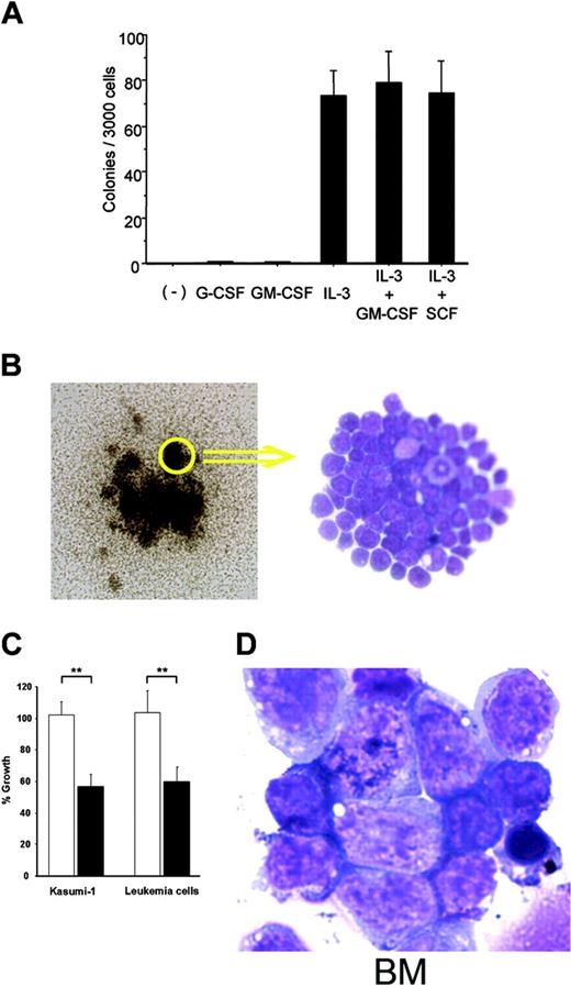 Figure 6. Transformation assays of the myeloblasts from the leukemic mice. (A) Colony assays of splenocytes from leukemic mice in methylcellulose medium-containing cytokines. The mean values ± SD of 3 independent assays are shown. (B) Leukemic blast cell colonies formed in methylcellulose containing IL-3 and GM-CSF (left; original magnification, × 60) and May-Giemsa staining of cells from these colonies (right; original magnification, × 400) are shown. (C) Growth inhibition of leukemic blast cells by WT1 antisense oligomers. Leukemic blast cells and AML1-ETO-expressing Kasmi-1 cells were treated with WT1 AS or random oligomers, and the numbers of viable cells were counted at 72 hours after the start of treatment. Open and closed columns represent random oligomers and WT1 AS, respectively. The percent growth was defined as the ratio of the number of viable cells treated with WT1 AS or random oligomers to that of cells treated with PBS. **P < .005. (D) May-Giemsa-stained BM cells from mice that received a transplant of the splenocytes from the leukemic mice (original magnification, × 1000). (B right, D) Images were visualized and acquired as described in Figure 4B.