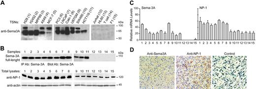 Figure 1. Expression of Sema-3A and NP-1 in tumor cells and renal cell carcinomas. (A) Western blot detection of secreted Sema-3A in concentrated (5 ×) TSNs (150 μg) from the indicated cells using anti-Sema-3A specific antibody. (B) Total lysates from cell lines indicated in panel A were immunoprecipitated with anti-Sema-3A antibody (IP Ab: Sema-3A). Immune complexes were immunoblotted (Blot Ab) with anti-Sema-3A antibody to detect Sema-3A precursor (top). The same lysates (50 μg) were also processed to detect NP-1 by immunoblotting. Expression of actin was used as internal control. Data are representative of 3 experiments. Sizes are shown in kilodaltons. (C) Total RNA (50 ng/μL) was isolated from the indicated cells and subjected to real-time PCR, as described in “Materials and methods,” to detect SEMA3A and NP1 transcripts. The mRNA levels of each gene were normalized by the mRNA levels of housekeeping gene glyceraldehyde-3-phosphate dehydrogenase (GAPDH). Reported values are an average of 3 separate samples of each type analyzed in triplicate; bars, ± SE. (D) Immunoperoxidase staining of a paraffin-embedded tissue section of a representative human renal cell carcinoma specimen (Clear cell type, grade 3, stage I) using an anti-Sema-3A and anti-NP-1 antibody or the same dilution of a control IgG (magnification, × 40). Scarce amounts of Sema-3A and NP-1 were also detected in normal renal tissue (data not shown). Antibody localization was effected using a peroxidase reaction with 3,3-diaminobenzidine tetrahydrochloride as chromogen.