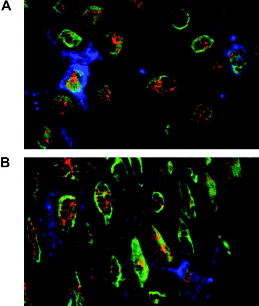 Figure 4. ESE-3 is expressed in Langerhans cells. Immunohistologic staining of normal skin using antibodies against CD1a (blue) for the detection of Langerhans cells and ESE-3 (red). The nuclei are stained with YOPRO (green).