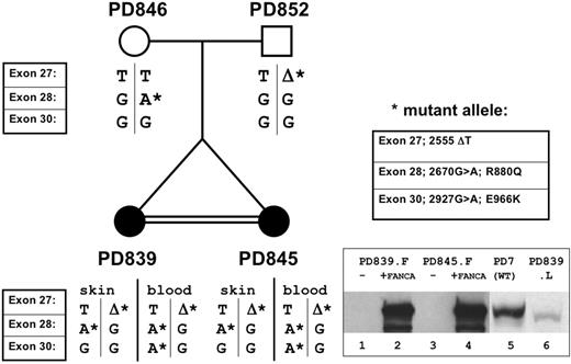 Figure 1. Pedigree and haplotypes of immediate family members. Parents carried one mutation each; daughters were compound heterozygotes. An acquired mutation downstream of the maternally inherited mutation was found in the whole blood of both patients. Inset: Western blot showing FANCA levels for cell lines derived from sisters versus controls. Fibroblasts and lymphoblasts were analyzed separately.
