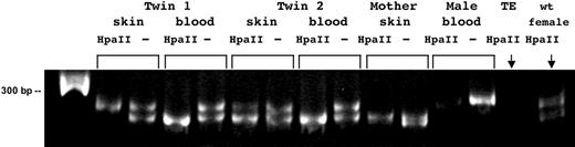 Figure 6. Skewing of X chromosome inactivation. Products from PCR with Hpa II digested and mock-digested templates. Order of lanes: 100-bp ladder; then, paired, PCRs of digested and mock-digested DNA from: fibroblasts from one twin, whole blood from that twin, fibroblasts from second twin, whole blood from second twin, and fibroblasts from mother; then, as controls, Hpa II-digested and mock-digested male DNA as digestion controls, Hpa II-“digested” TE and Hpa II-digested female DNA as nonskewed control.