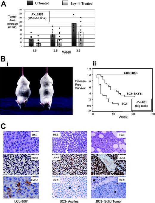 Figure 4. Treatment of NOD/SCID mice with Bay 11-7082 delays the development of EBV- and KSHV-associated lymphomas in vivo. (A) NOD/SCID mice (n = 10/group) were challenged with 40 × 106 LCL 9001 cells and subsequently received injections of vehicle or 20 mg/kg Bay 11 on days 1, 3, and 5 after tumor challenge and at weekly intervals thereafter. Tumors were measured on a weekly basis; tumor area for each mouse is shown by a dot, and average size is illustrated by the bar graph for each group. Differences evaluated by RMANOVA revealed significant differences in tumor size (P < .0352) between vehicle and Bay 11-treated mice averaged over all time points. (B) (i) Murine model of primary effusion lymphoma. The mouse on the left received injection of BC-3 cells and developed lymphomatous ascites, as evidenced by abdominal distention. The mouse on the right was a healthy control mouse. (ii) Disease-free survival curves. NOD/SCID mice (n = 19/group) were challenged with 10 × 106 BC-3 cells and then received injections of vehicle or Bay 11-7082 (5 or 20 mg/kg) on days 1, 3, and 5 after tumor injection. Disease-free survival evaluated by Kaplan-Meier and log rank test showed significant differences in tumor development in Bay 11 and vehicle-treated mice (P < .001 for 5 and 20 mg/kg groups). There was no major difference among the curves for the 5- and 20-mg/kg dose groups, so only the 5-mg/kg data are shown. The control group represents mice that did not receive injections of tumor cells. (C) Cells from ascites and solid tumors in BC-3- and LCL 9001-challenged mice were evaluated for morphology and viral antigen expression after tumor development. Cells were stained with hematoxylin and eosin (H&E); for KSHV, they were further evaluated with antibodies to LANA and vIL-6, and for EBV they were further evaluated with antibodies to LMP-1 and by in situ hybridization for EBER. Original magnification, 100 ×, except LCL H&E and LMP-1, for which original magnification was 400 ×.