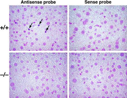 Figure 2. In situ hybridization analysis of ADAMTS13 mRNA. Liver sections from Adamts13+/+ (top panels) and Adamts13–/– (bottom panels) mice were hybridized to the antisense (left panels) or sense (right panels) Adamts13 RNA probes. The hybridized sections were counterstained with Kernechtrot solution. Typical positive signals are indicated by arrows.