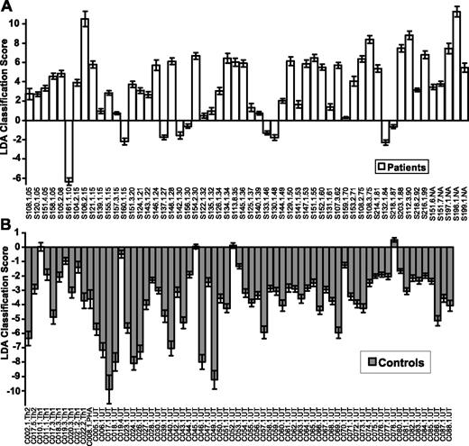 Figure 2. Classification of Sézary patients using qPCR data. Data shown are for analysis using FLDA. Scores for patient samples are shown in panel A, and controls are shown in panel B. The dataset consists of 125 samples: 56 from 49 patients with erythrodermic CTCL and 69 from 65 controls. The controls are untreated (UT), Th1 skewed (Th1), Th2 skewed (Th2), and PHA treated (PHA). The patient samples are sorted according to the blood tumor burden (5% to 99%) indicated by the last 2 digits of the label. Patients in whom percent Sézary was not available are indicated as “NA.” A positive score indicates the sample is classified as a patient; a negative score indicates the sample is classified as a control. The height of each bar represents the average score that a given sample received, when tested approximately 100 times, during 1000 random resamplings. The error bars indicate the standard deviation in the generated set of scores for the sample. Sézary samples (S) are followed by a 3-digit patient donor code. Serial samples taken at different times from the same patient are indicated by an additional number (ie, S151.1, S151.4) and followed by the percent Sézary cells present. None of the controls was sampled more than once, but samples from donors C017, C018, and C019 were also skewed to the Th1 (C017, C018, C019) and Th2 (C017) phenotype. The classifier has a sensitivity of 86% and a specificity of 95% on this dataset.
