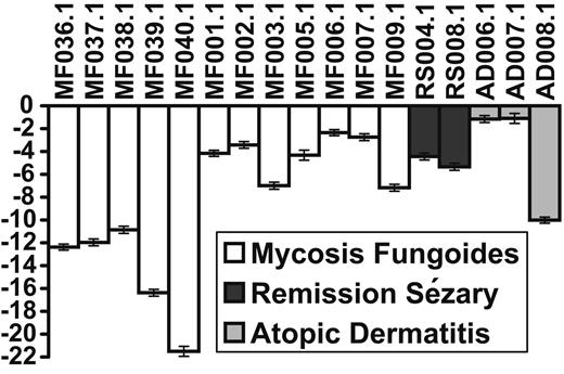 Figure 4. Classification of samples from MF/CTCL, atopic dermatitis, and SS/CTCL in remission. A positive score indicates the sample is classified as an SS; a negative score indicates the sample is classified as a non-SS. The length of each bar represents the average score over 1000 random resamplings, and the error bars indicate the standard deviation in the scores generated by the resamplings. MF indicates mycosis fungoides; RS, SS patient in remission; AD, atopic dermatitis.
