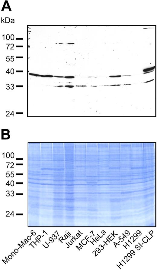 Figure 3. Expression of SI-CLP protein in human cell lines. (A) Western blot analysis of total cell lysates using rat mAb 1C11. Endogenous SI-CLP is represented by specific bands corresponding to MW of about 39 kDa and 33 kDa. In stable transfected H1299-SI-CLP cells, the strongest SI-CLP band has a MW of about 40 kDa. None of these bands is recognized by isotype control rat IgG2a and rat IgGs (data not shown). (B) Loading control.