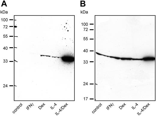 Figure 5. SI-CLP protein level is up-regulated in human macrophages by IL-4 and dexamethasone. Western blot analysis with 1C11 rat mAb shows individual differences in response to various stimulations. (A) Macrophages derived from donor 140.3 show strong up-regulation of SI-CLP under stimulation with IL-4 and dexamethasone. (B) Macrophages derived from donor 147.3 show intermediate-level SI-CLP up-regulation under stimulation with IL-4 and dexamethasone.