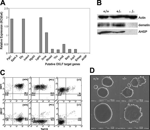 Figure 3. EKLF-null primitive erythroid cells show defects in gene expression and structure. (A) Relative expression levels of putative EKLF target genes in E11.5 EKLF-/- blood cells compared with EKLF+/+. Levels were measured by real-time PCR and normalized to HPRT. Data are presented as mean, n = 2. (B) Representative Western blot of dematin and AHSP expression in whole-cell extracts from E11.5 blood cells. Actin is presented as a loading control. (C) Representative dot plots of FACS-sorted E11.5 blood cells from EKLF+/+, EKLF+/-, and EKLF-/- mice stained with TER119-PE and either CD71-FITC (transferrin receptor) or CD117-FITC (c-kit). The top and right quadrants represent positive stained cells. The percentage of cells in each quadrant is indicated. (D) Scanning electron microscopy of cytospin preparations of primitive erythroid cells from E11.5 EKLF+/+ and EKLF-/- embryos. The small enucleated discs represent maternal red cells and the large nucleated cells are yolk sac-derived primitive erythrocytes. Scale bars and magnification are shown.