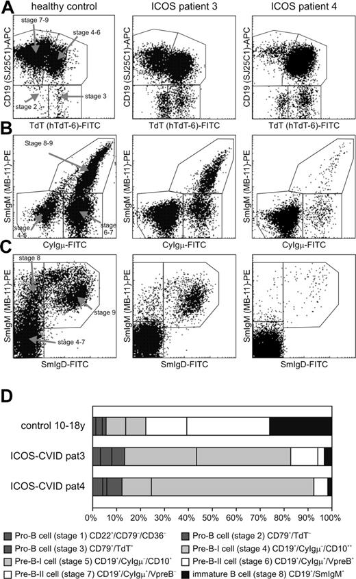 Figure 4. Relative increase of pre–B-1 B cells in the bone marrow of ICOS-deficient patients. Eight different precursor B-cell stages are defined and 1 mature IgM+/IgD+ B-cell stage. The pro-B and pre–B-I cell subsets (stages 1-5) of ICOS-deficient patients 3 and 4 show a relative increase as compared with the healthy control subject. (A) Analysis of expression of TdT and CD19 within a purified cytoplasmic (cy) CD79a+ lymphogate discriminates 4 different B-cell populations: a TdT–/CD19– (stage 2) and a TdT+/CD19– (stage 3) pro–B-cell subset, a TdT+/CD19+ B-cell population (pre–B-I/pre–B-II stage 6), and a TdT–/CD19+ (pre–B-II stage 7, immature and mature B cells). (B) Analysis of CyIgμ and surface membrane (Sm) IgM within a purified CD19+ lymphogate discriminates pre–B-I (CyIgμ–/SmIgM–), pre–B-II (CyIgμ+/SmIgM–), and immature/mature (CyIgμ+/SmIgM+) B-cell subsets. (C) Analysis of SmIgM and SmIgD within a purified CD19+ lymphogate discriminates the pre–B-I and pre–B-II cell subsets together (SmIgM–/SmIgD–), the immature B cells (SmIgM+/SmIgD–), and the mature B cells (SmIgM+/SmIgD+). (D) Schematic representation of the precursor B-cell compartment in a healthy donor and ICOS-deficient patients 3 and 4. The size of the 8 precursor B-cell stages is set to 100%.