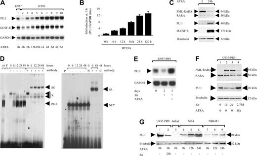 Figure 3. ATRA restores PU.1 expression in APL cells. (A) Northern blot analysis of HT93A cells treated with 1 μM ATRA and harvested at the time points indicated. The blot was probed for PU.1 (top), G-CSF receptor (middle), and GAPDH expression (bottom). (B) HT93A cells were treated with 1 μM ATRA. PU.1 mRNA expression was determined by quantitative real-time PCR. Results are given as fold induction of the PU.1/GAPDH ratio compared with the value of HT93A cells before treatment (0 hours). Mean values and SD (error bars) are depicted. (C) Western analysis using a RARA antiserum (top), a PU.1 antibody (second), an M-CSF receptor antibody (third), and a β-tubulin antiserum (bottom). HT93A cells were harvested before and after ATRA treatment for 24 hours. (D) EMSA of DNA-binding activity to the PU.1 site in the M-CSF receptor promoter. HT93A cells were stimulated with 1 μM ATRA and harvested at the time points indicated. ivt indicates in vitro-translated PU.1 protein; P, free probe alone; SS, supershift with specific antibody; PU.1, shift of PU.1 protein binding to this particular site; and X, nonspecific binding. The panel on the right represents binding of the same extracts to an NFY site as a control for loading and integrity of the extracts. N indicates treatment of the extracts with normal rabbit serum; and C, competition with cold oligo. (E) ATRA treatment overcomes the suppressive effect of PML-RARA on PU.1 expression. Northern blot showing PU.1 mRNA expression of U937-PML/RARA (U937-PR9) cells (top). Lane 1 depicts U937-PML-RARA cells in the absence of zinc or ATRA. Lane 2 shows U937-PR9 cells after 2 days of treatment with zinc (100 μM); lane 3 demonstrates U937-PR9 cells after 2 days of treatment with zinc (100 μM) and also treated with both ATRA (1 μM) and zinc for the last 24 hours. The same blot was probed for GAPDH (bottom). (F) Western blot analysis of whole-cell lysates of U937-PR9 cells. Lane 1 represents unstimulated cells. Cells were induced with zinc for 1 and 2 days (lanes 2 and 3). In lane 4 cells were treated for 48 hours with zinc, and then for 18 hours with both zinc and ATRA. Top: Staining with a RARA antibody detecting the fusion protein PML-RARA and the endogenous RARA. Middle: Probing the same blot with an antibody-detecting PU.1 protein. Bottom: The blot was restained for β-tubulin. (G) ATRA sensitivity is a prerequisite for PU.1 restoration in APL cells. Whole-cell lysates were analyzed by Western blot using a PU.1 antibody. Unstimulated U937-PR9 cells (lane 1) served as a positive control and Jurkat cells as a negative control (lane 3). Lane 2 shows U937-PR9 cells after 24 hours of PML-RARA induction. NB4 cells (lanes 4 to 6) and the ATRA-resistant APL cell line NB4-R1 (lanes 7 to 9) were induced for 12 or 24 hours with 1 μM ATRA. The blot was restained for β-tubulin (bottom).