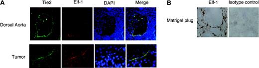 Figure 1. Expression of ELF-1 during vascular development and tumor angiogenesis. (A) Immunofluorescence staining in the developing dorsal aorta and B16 melanoma tumors for Tie2 (green) and ELF-1 (red), and colocalization (yellow) with DAPI staining (blue) for detection of cell nuclei. (B) Immunostaining for ELF-1 within endothelial cells of a Matrigel plug, supplemented with bFGF (80 ng/mL), injected subcutaneously into C57BL/6 nu/nu mice with an isotype-matched control.
