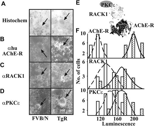 Figure 5. AChE-R, RACK1, and PKC ϵ expression in megakaryocytes. (A) BM smears were stained with May-Grünwald (A) and specific antibodies to detect AChE-R (B), RACK1 (C), and PKCϵ (D). Arrows indicate labeled cells. (E) Illustration of the putative interaction between the 3 proteins. (F) Population distributions of Mk-labeling intensities for AChE-R, RACK1, and PKCϵ. □ represent FVB/N, and , TgR mice BM-labeling intensities. Note the shift to the right, indicating increased levels of these 3 proteins in Mks from TgR as compared with FVB/N mice. n = 50 cells per test. *P < .01, Student t test.