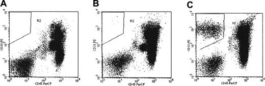 Figure 1. Detection of circulating myeloma cells (CMCs) by flow cytometry. CMCs are detected by gating for a population of CD38+/CD45- cells. Healthy individuals do not have any cells in the CD38+/CD45- gate (A). Panels B and C represent patients with a few (5) or many (1080) CMCs, respectively. Each analysis evaluates 50 000 events.