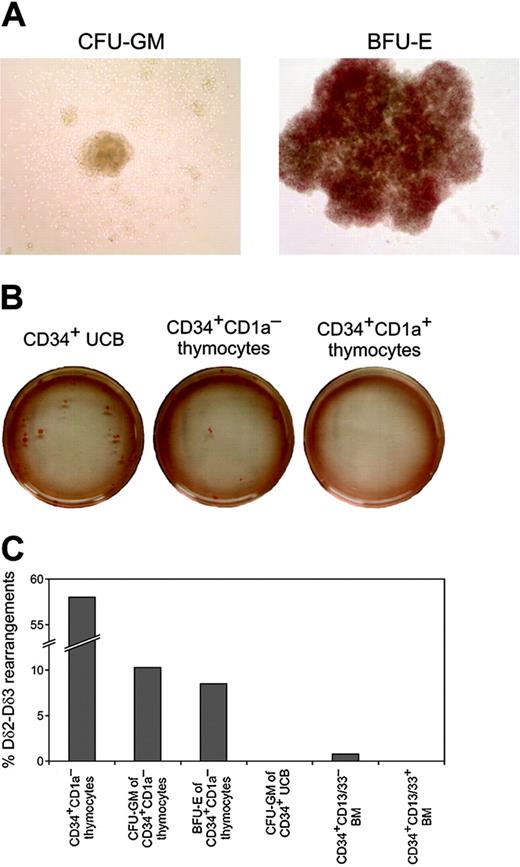 Figure 3. In vitro colony assays. Sorted CD34+CD1a– and CD34+CD1a+ thymocytes and CD34+ UCB cells were plated in semisolid cultures containing appropriate cytokines to generate myeloid (CFU-GM) or erythroid (BFU-E) colonies. (A) Typical myeloid (left) and erythroid (right) colonies generated from CD34+CD1a– thymocytes. (B) Overview of BFU-E dishes in which 105 CD34+CD1a– or CD34+CD1a+ thymocytes or 103 CD34+ UCB cells were plated. No colonies were detected in dishes with CD34+CD1a+ thymocytes. (C) RQ-PCR analysis of immature TCRD gene rearrangements (Dδ2-Dδ3) in original CD34+CD1a– thymocytes, myeloid and erythroid colonies generated from CD34+CD1a– thymocytes, myeloid colonies generated from CD34+ UCB cells, and CD34+ cells from children's BM sorted into either CD13/33– (mostly B-cell progenitors) and CD13/33+ (myeloid progenitors) fractions. Percentages of rearranged alleles in each sample are shown.