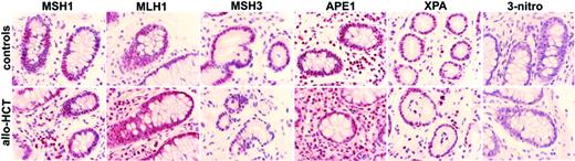 Figure 2. Immunohistochemistry for DNA repair proteins and 3-nitrotyrosine in colon biopsies. Expression of MLH1, MSH2, MSH3, XPA, and APE1 was similar in the colon biopsies obtained from subjects who did not receive a transplant with no relevant medical history (top) and from patients who received an allograft (bottom). There was no immunostaining for 3-nitrotyrosine in either group. Representative photographs are shown (× 600). Image acquisition performed as described for Figure 1.