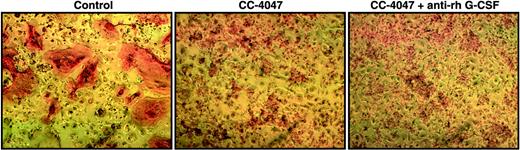 Figure 6. CC-4047–triggered shift of lineage commitment of hematopoietic progenitors is not induced by CSF-G. Nonadherent bone marrow cells from HBM were cultured with 10 ng/mL CSF-M and 50 ng/mL RANKL for 21 days. DMSO 0.1% (control), or CC-4047 (100 μM) alone or in combination with anti–rh CSF-G neutralizing antibody (16 μg/mL) were added to the culture twice a week. Following 3 weeks of treatment, cells were fixed and stained with 23c6 antibody to detect mature multinucleated OCLs. Images were obtained as described for Figure 2.