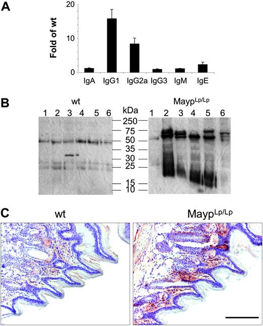 Figure 4. Elevation of circulating immunoglobulin and autoantibodies in 4-month-old MaypLp/Lp mice. (A) Serum immunoglobulin levels expressed as the fold increase of their concentration in MaypLp/Lp (n = 5) compared with WT (n = 17) mice (± SD). Elevations of IgG1, IgG2a, and IgE are significant (P < .05; Student t test). (B) Twelve lanes, each containing identical amounts of a single extract of normal paw proteins, were subjected to SDS-PAGE and Western blot analysis with individual sera of 6 MaypLp/Lp mice expressing serum immunoglobulin and of 6 WT mice. (C) Immunohistochemistry using serum from a MaypLp/Lp mouse as primary antibody, showing that the cognate proteins are located in the papillary layers of the corium. Similar results were obtained for 3 additional MaypLp/Lp sera. Bar, 100 μm.