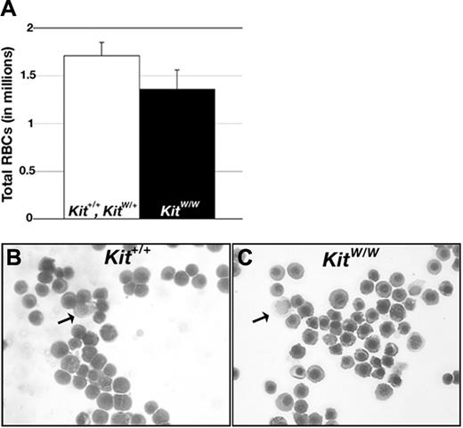 Figure 6. c-kit signaling is not required for primitive erythropoiesis in mice. (A) Average number of primitive RBCs in individual E11.5 littermates generated from KitW/+ intercrosses (Kit+/+, n = 3, KitW/+, n = 7; KitW/W, n = 5). Error bars show the SEM. (C-D) Wright-Giemsa–stained blood collected from Kit+/+ (B) and KitW/W (C) embryos. Arrows point to leukocytes, remaining cells are erythrocytes.