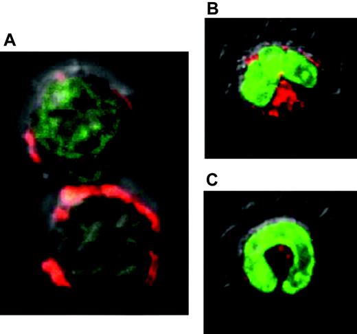 Figure 2. Nuclear localization effect of the GFP-MGMT* fusion protein in marked blood cells. Confocal microscopy image of GFP expression in peripheral blood (A) lymphocytes, (B) monocytes, and (C) granulocytes of in vivo–treated XSCID dog 1547. Note the green nuclei due to nuclear localization effect of MGMT* from the GFP-MGMT* fusion protein. Staining with an (A) anti-CD3 and (B-C) antineutrophil/antimonocyte monoclonal antibody with secondary red-Alexa Fluor–labeling confirms morphologic diagnosis.